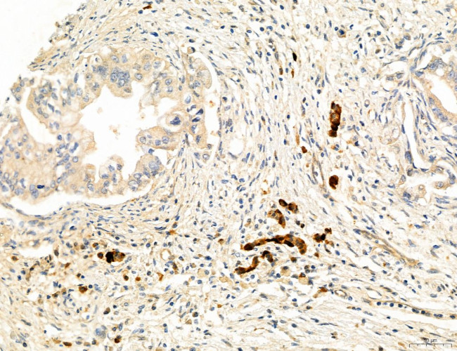 CHOP Antibody in Immunohistochemistry (Paraffin) (IHC (P))