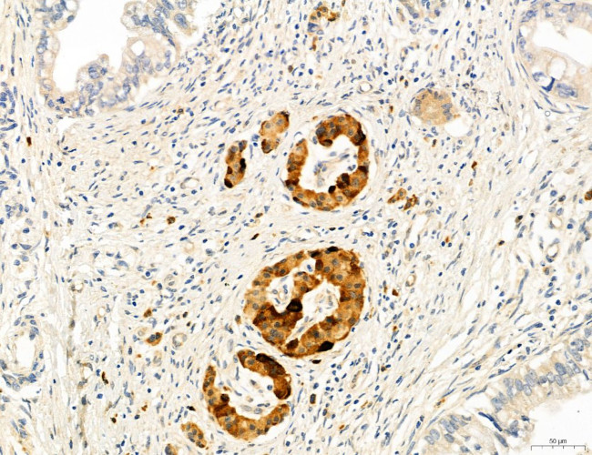 CHOP Antibody in Immunohistochemistry (Paraffin) (IHC (P))