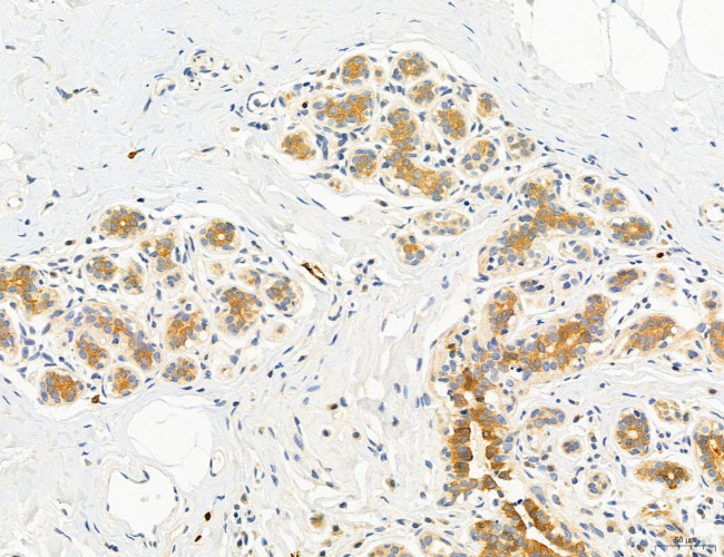 CHOP Antibody in Immunohistochemistry (Paraffin) (IHC (P))