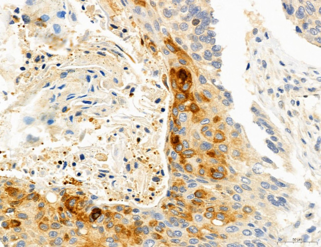 CHOP Antibody in Immunohistochemistry (Paraffin) (IHC (P))