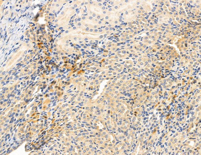 CHOP Antibody in Immunohistochemistry (Paraffin) (IHC (P))