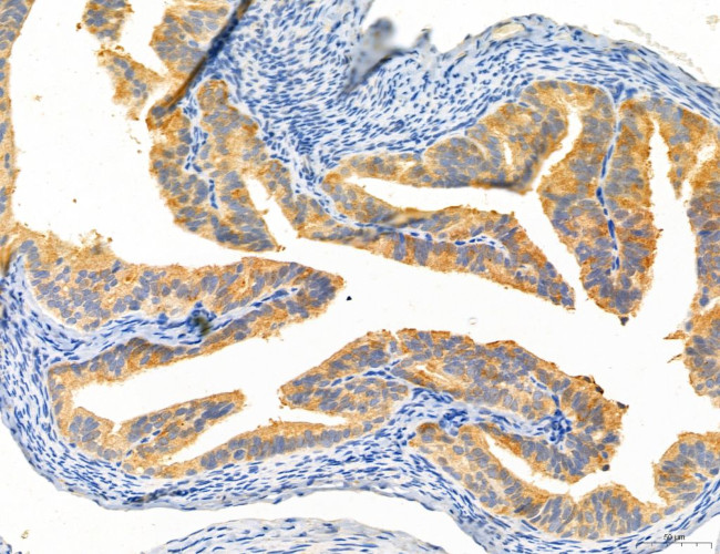 CHOP Antibody in Immunohistochemistry (Paraffin) (IHC (P))