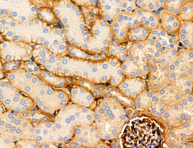 CHOP Antibody in Immunohistochemistry (Paraffin) (IHC (P))