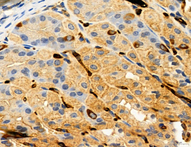 CHOP Antibody in Immunohistochemistry (Paraffin) (IHC (P))