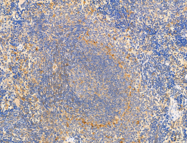 CHOP Antibody in Immunohistochemistry (Paraffin) (IHC (P))