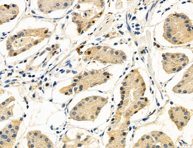 CHOP Antibody in Immunohistochemistry (Paraffin) (IHC (P))