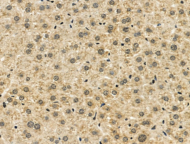 NUDT6 Antibody in Immunohistochemistry (Paraffin) (IHC (P))