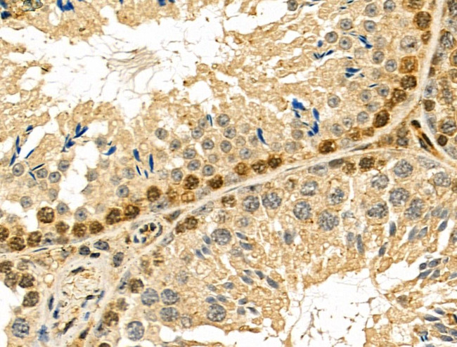 NUDT6 Antibody in Immunohistochemistry (Paraffin) (IHC (P))