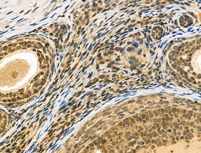 NUDT6 Antibody in Immunohistochemistry (Paraffin) (IHC (P))