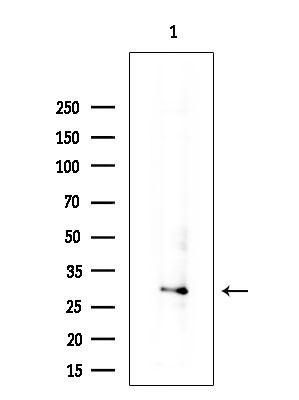 NUDT6 Antibody in Western Blot (WB)