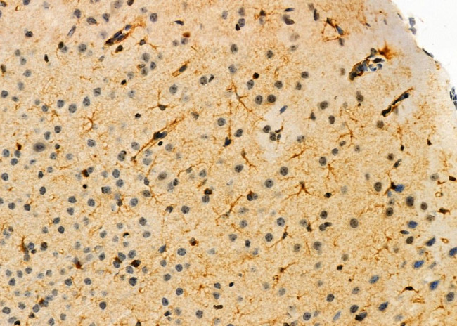 OLFM1 Antibody in Immunohistochemistry (Paraffin) (IHC (P))