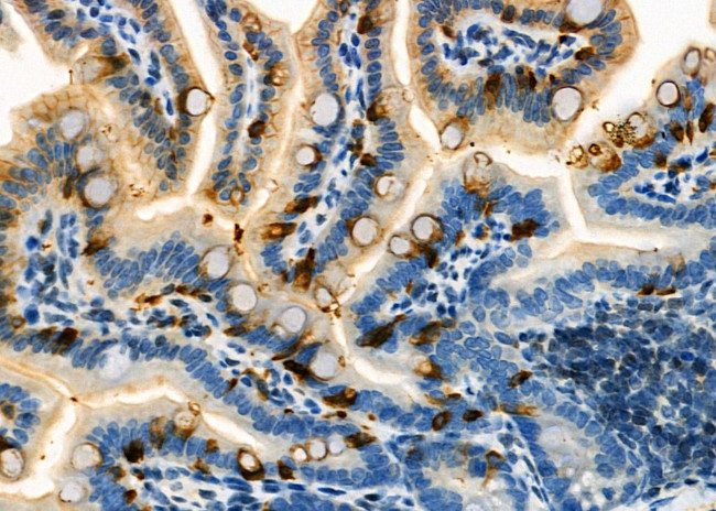 TCL1A Antibody in Immunohistochemistry (Paraffin) (IHC (P))