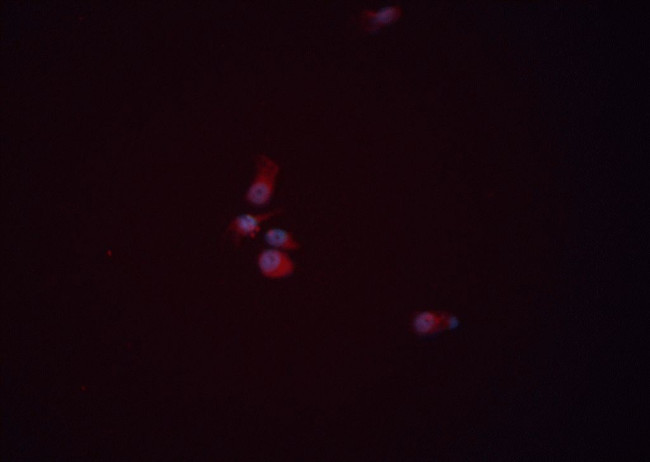 WNT3A Antibody in Immunocytochemistry (ICC/IF)