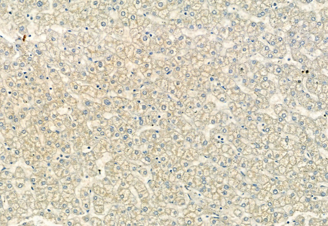 ACVR1C Antibody in Immunohistochemistry (Paraffin) (IHC (P))