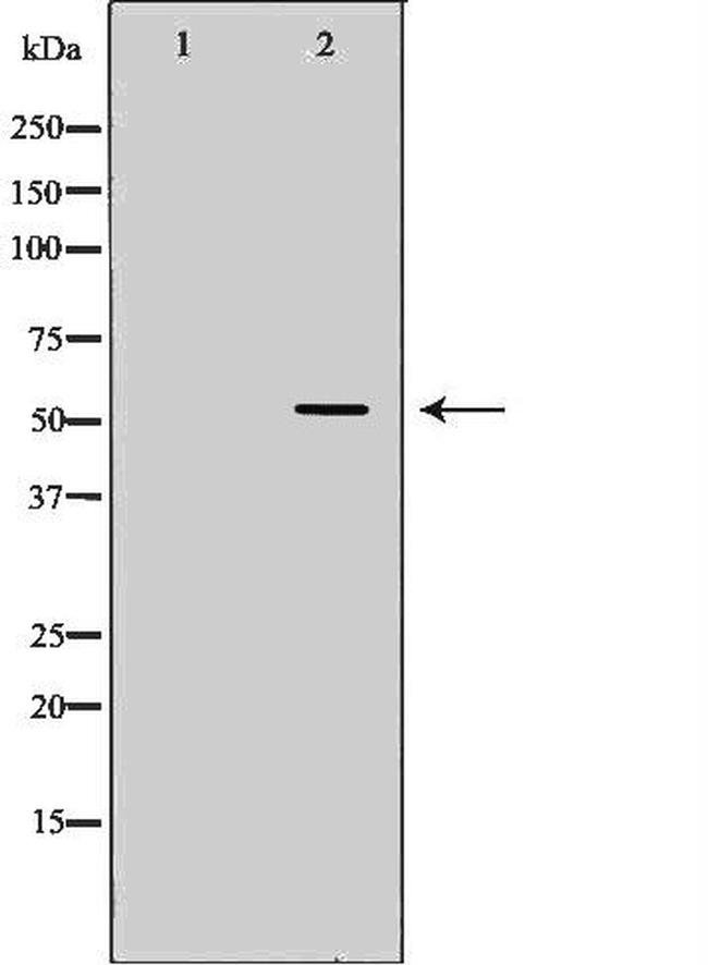 ACVR1C Antibody in Western Blot (WB)