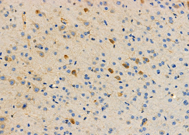 SNX9 Antibody in Immunohistochemistry (Paraffin) (IHC (P))