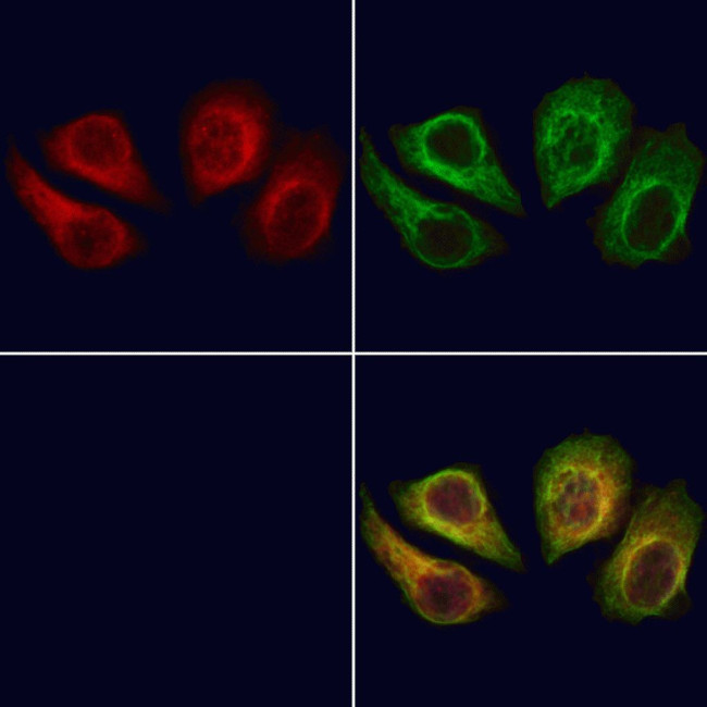 NEK8 Antibody in Immunocytochemistry (ICC/IF)