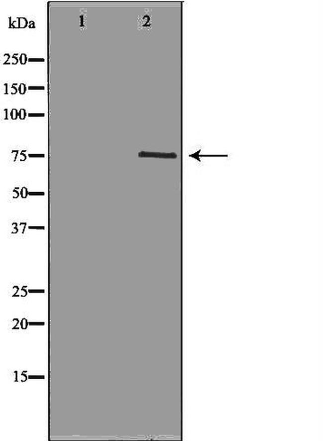 NEK8 Antibody in Western Blot (WB)