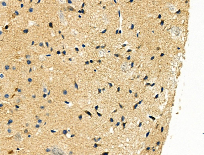 ID2 Antibody in Immunohistochemistry (Paraffin) (IHC (P))