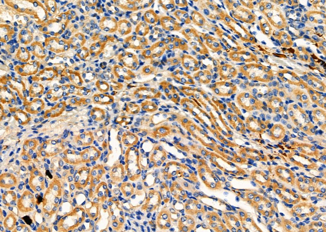 TPMT Antibody in Immunohistochemistry (Paraffin) (IHC (P))