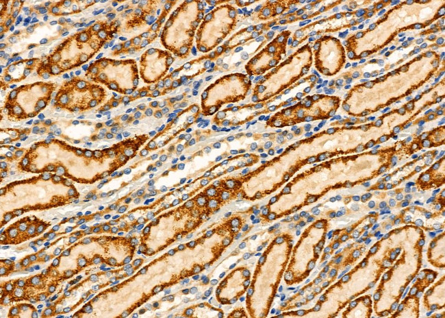 TPMT Antibody in Immunohistochemistry (Paraffin) (IHC (P))