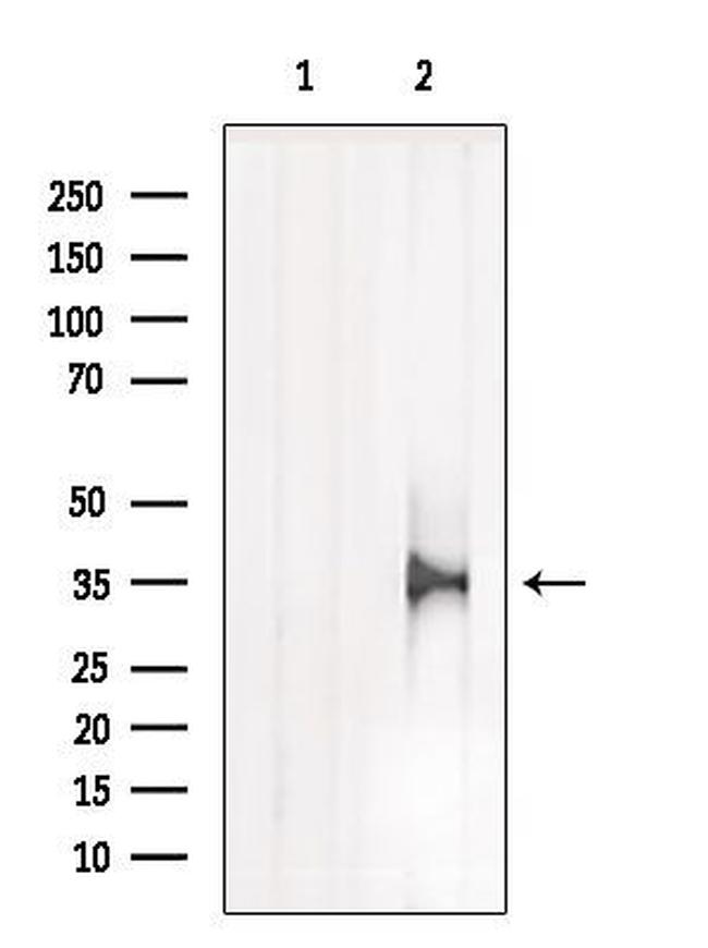 TPMT Antibody in Western Blot (WB)