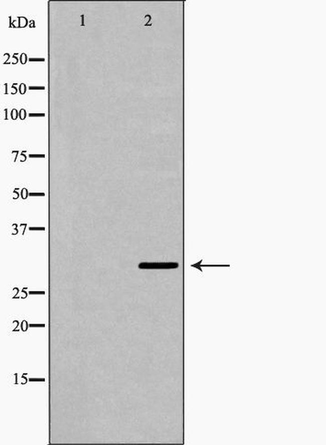 Carbonic Anhydrase I Antibody in Western Blot (WB)