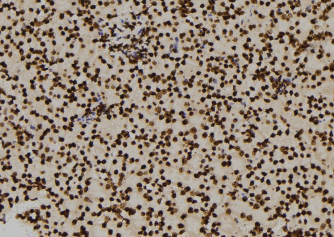 ENO1 Antibody in Immunohistochemistry (Paraffin) (IHC (P))