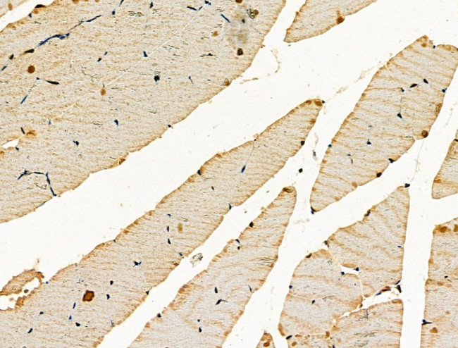 ENO1 Antibody in Immunohistochemistry (Paraffin) (IHC (P))