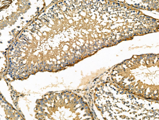 ENO1 Antibody in Immunohistochemistry (Paraffin) (IHC (P))