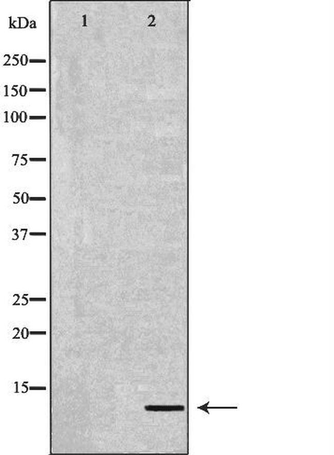 DEFB132 Antibody in Western Blot (WB)