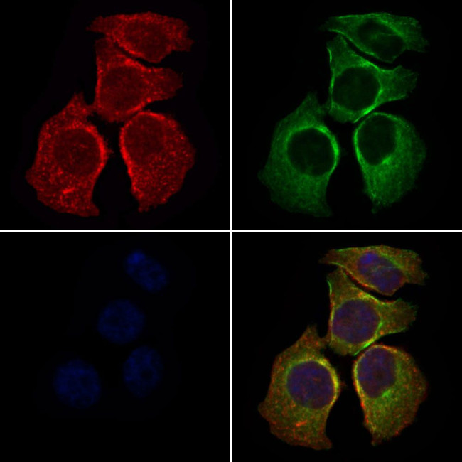 SLC27A2 Antibody in Immunocytochemistry (ICC/IF)