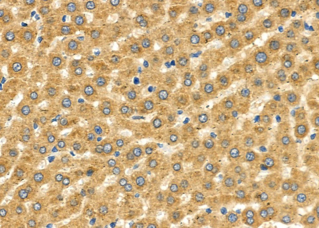 SLC27A2 Antibody in Immunohistochemistry (Paraffin) (IHC (P))