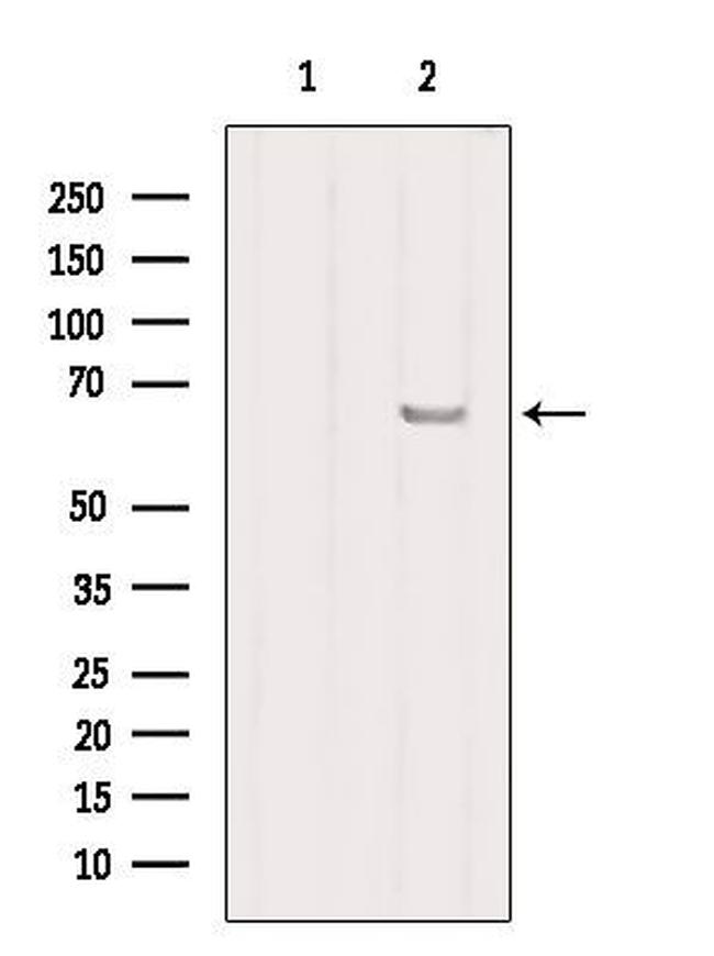 SLC27A2 Antibody in Western Blot (WB)