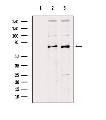 SLC27A2 Antibody in Western Blot (WB)