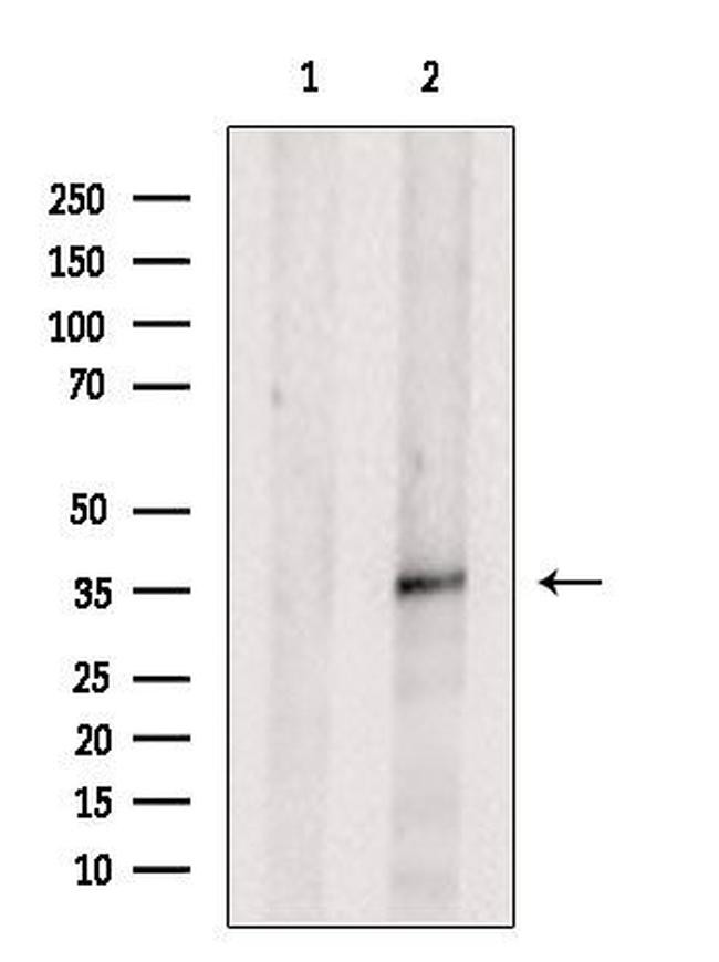 PP1 beta Antibody in Western Blot (WB)