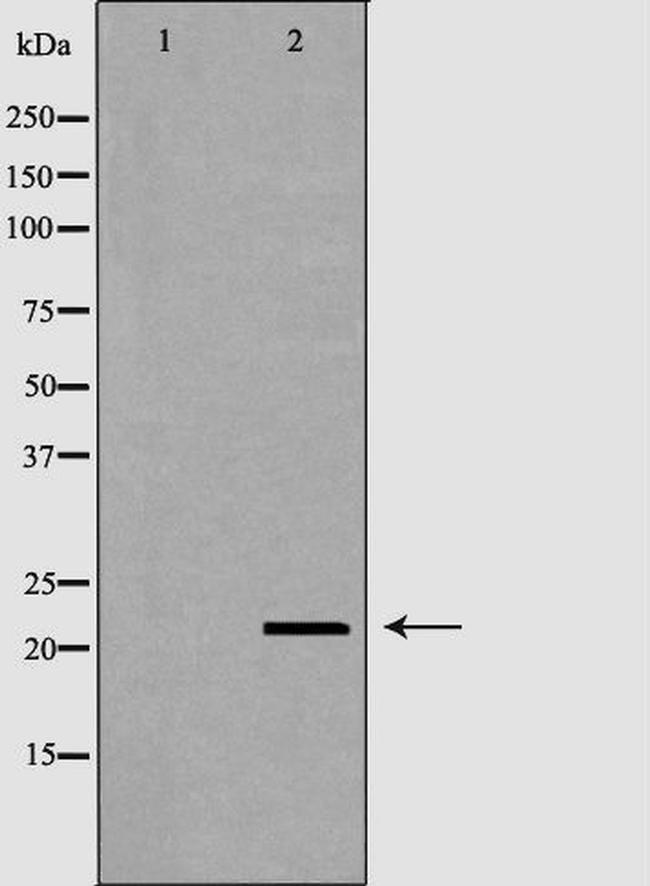 RNase11 Antibody in Western Blot (WB)