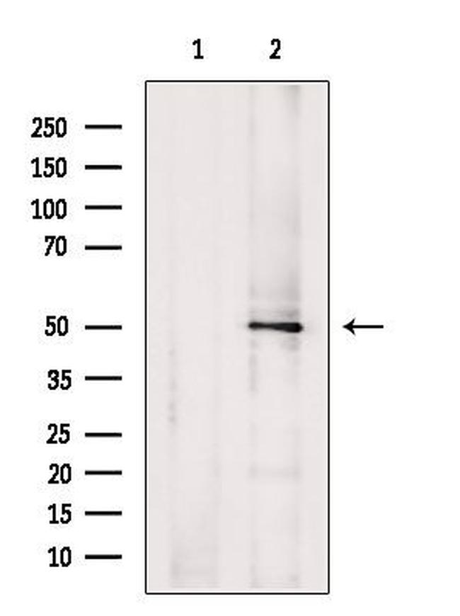 TYMP Antibody in Western Blot (WB)