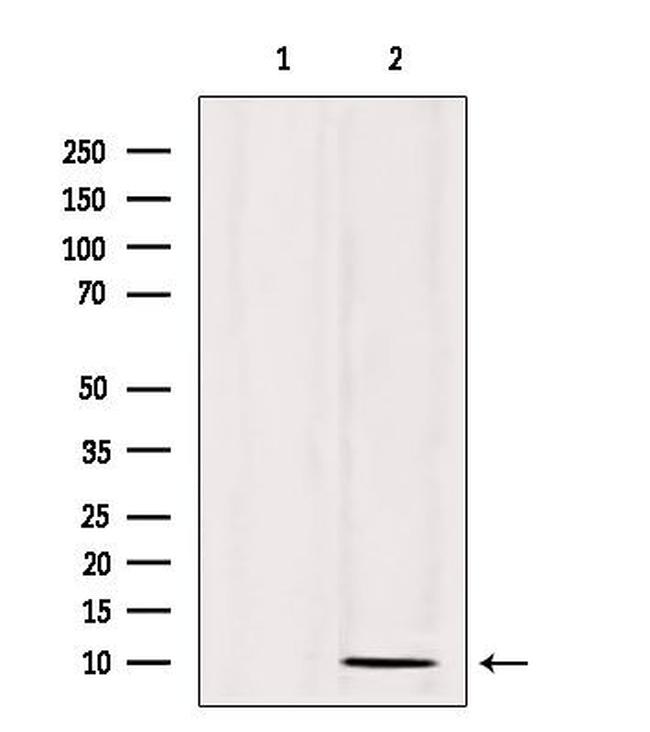 SPINK1 Antibody in Western Blot (WB)