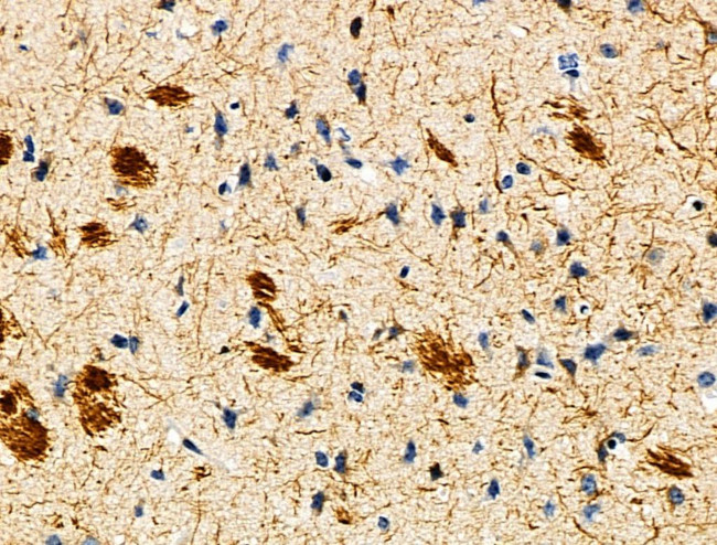 CYR61 Antibody in Immunohistochemistry (Paraffin) (IHC (P))