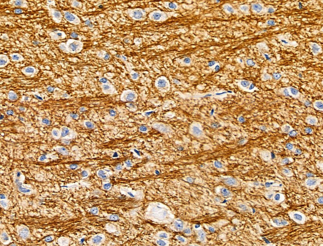 CYR61 Antibody in Immunohistochemistry (Paraffin) (IHC (P))