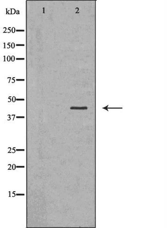 CYR61 Antibody in Western Blot (WB)