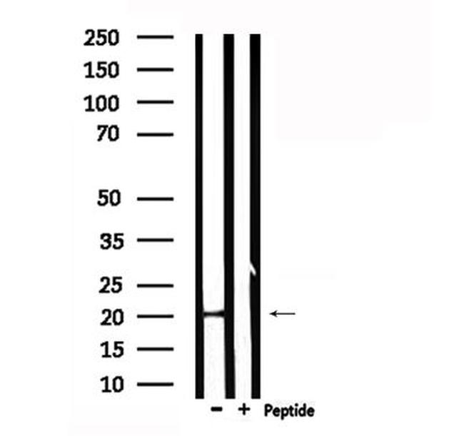 CRF Antibody in Western Blot (WB)