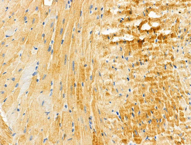 Cardiac Troponin T Antibody in Immunohistochemistry (Paraffin) (IHC (P))