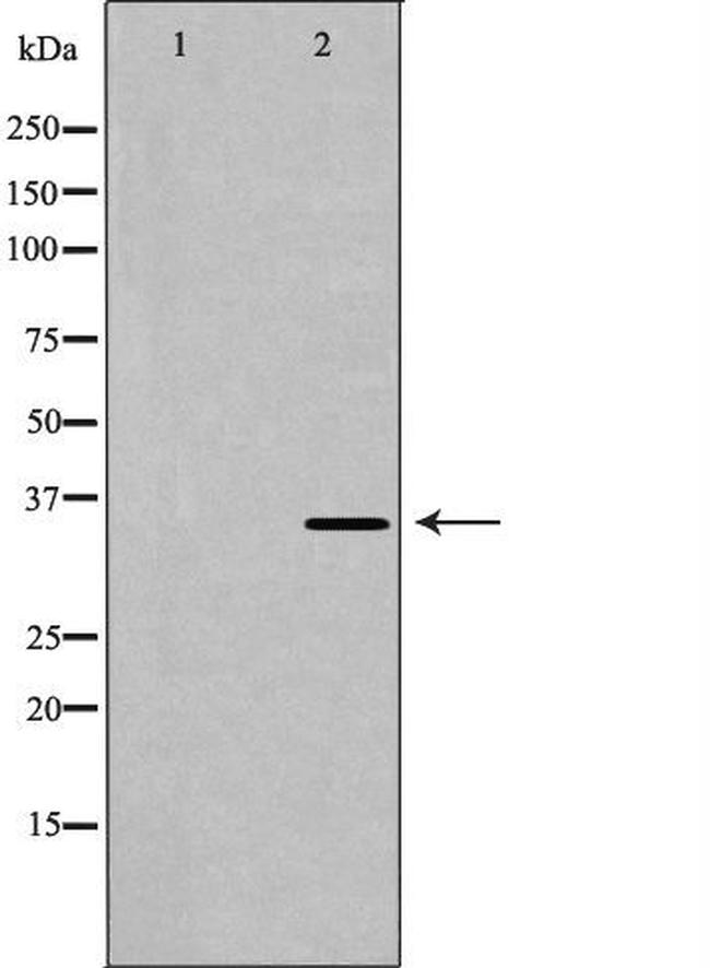 Cardiac Troponin T Antibody in Western Blot (WB)