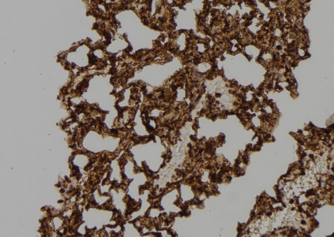 RAC2 Antibody in Immunohistochemistry (Paraffin) (IHC (P))