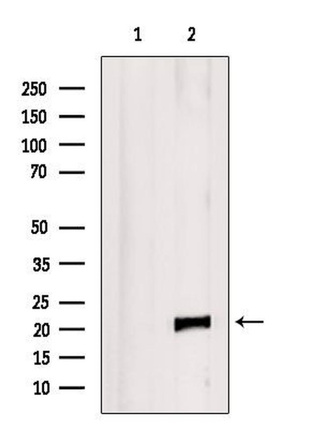 RAC2 Antibody in Western Blot (WB)