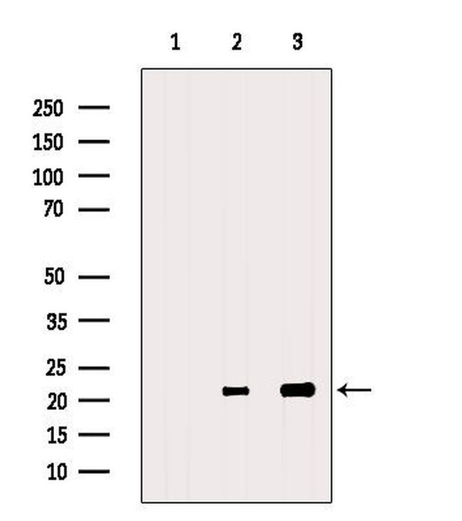 RAC2 Antibody in Western Blot (WB)