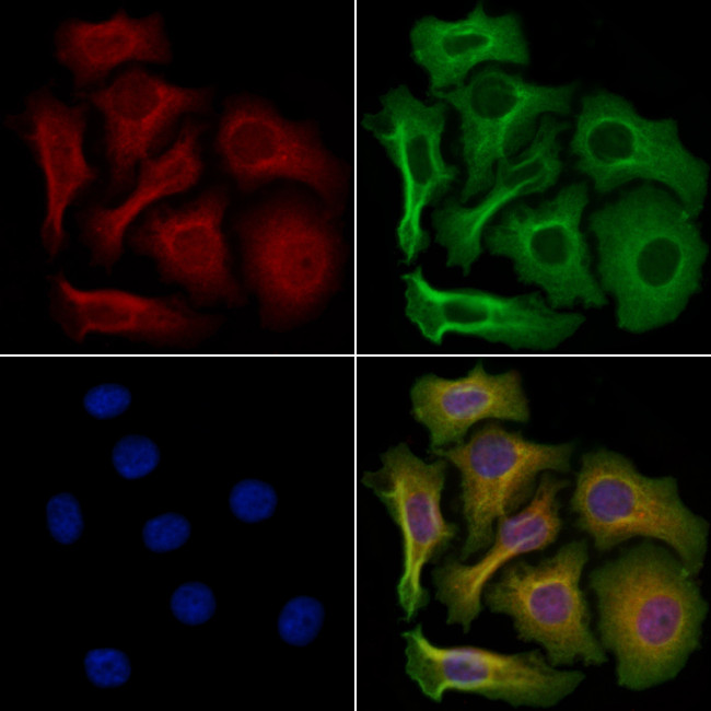 RAC2 Antibody in Immunocytochemistry (ICC/IF)