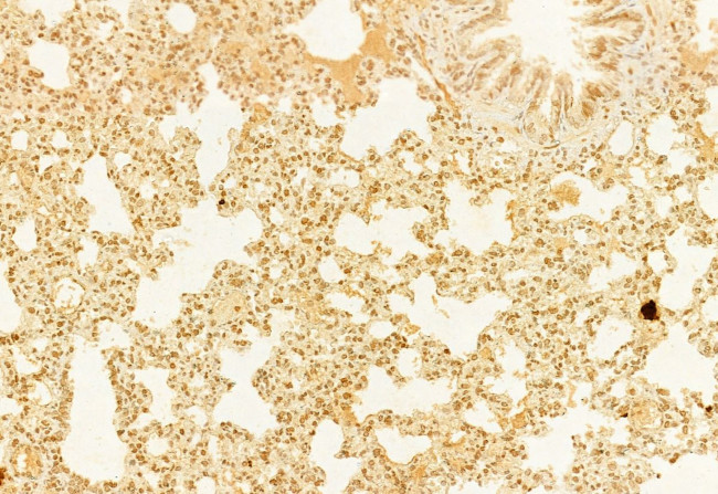 RAC2 Antibody in Immunohistochemistry (Paraffin) (IHC (P))